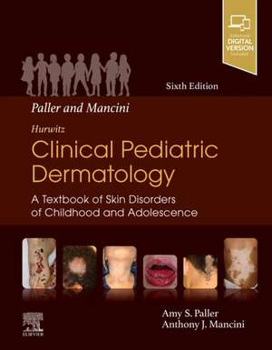 Paller and Mancini - Hurwitz Clinical Pediatric Dermatology: A Textbook of Skin Disorders of Childhood & Adolescence de Amy S Paller