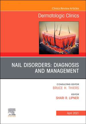 Nail Disorders: Diagnosis and Management, An Issue of Dermatologic Clinics de Shari Lipner