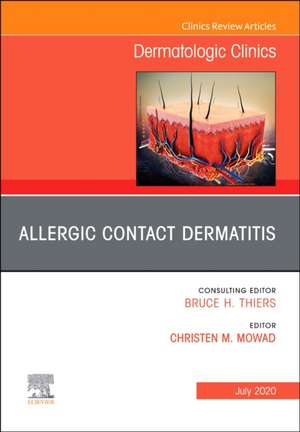 Allergic Contact Dermatitis,An Issue of Dermatologic Clinics de Christen M. Mowad