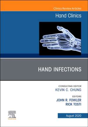 Hand Infections, An Issue of Hand Clinics de John Fowler