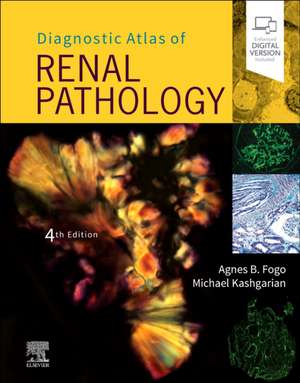 Diagnostic Atlas of Renal Pathology de Agnes B. Fogo