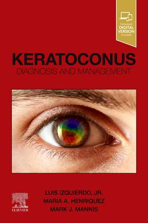 Keratoconus: Diagnosis and Management de Luis Izquierdo