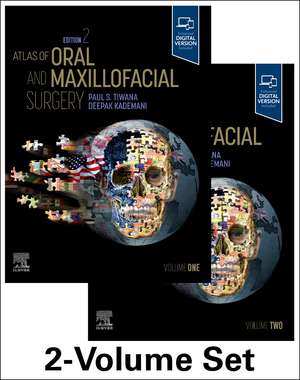 Atlas of Oral and Maxillofacial Surgery - 2 Volume SET de Paul Tiwana