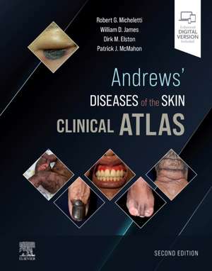 Andrews' Diseases of the Skin Clinical Atlas de Robert G. Micheletti