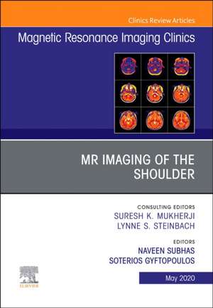 MR Imaging of the Shoulder, An Issue of Magnetic Resonance Imaging Clinics of North America de Naveen Subhas