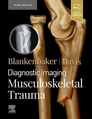 Diagnostic Imaging: Musculoskeletal Trauma de Donna G Blankenbaker