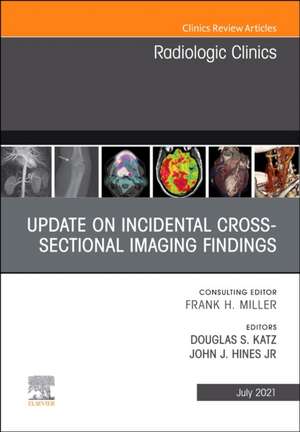 Update on Incidental Cross-sectional Imaging Findings, An Issue of Radiologic Clinics of North America de Douglas G Katz