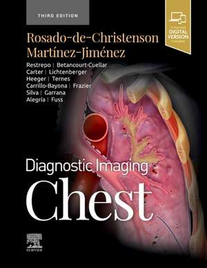 Diagnostic Imaging: Chest de Melissa L. Rosado-de-Christenson