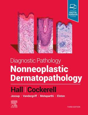 Diagnostic Pathology: Nonneoplastic Dermatopathology de Brian J. Hall