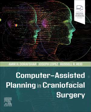 Computer-Assisted Planning in Craniofacial Surgery de Amir H Dorafshar