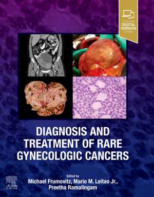 Diagnosis and Treatment of Rare Gynecologic Cancers and