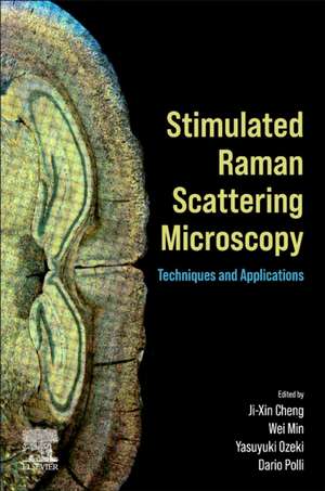 Stimulated Raman Scattering Microscopy: Techniques and Applications de Ji-Xin Cheng