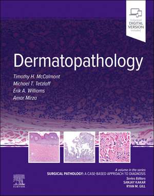 Dermatopathology: Surgical Pathology: A Case-Based Approach to Diagnosis de Tim McCalmont