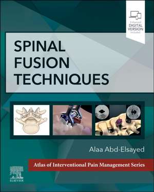 Spinal Fusion Techniques de Alaa Abd-Elsayed