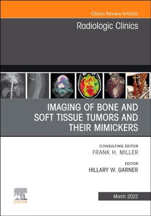 Imaging of Bone and Soft Tissue Tumors and Their Mimickers, An Issue of Radiologic Clinics of North America de Hillary W. Garner