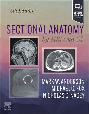 Sectional Anatomy by MRI and CT de Mark W. Anderson