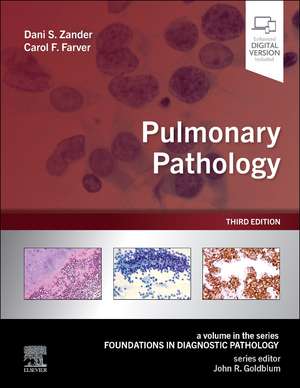 Pulmonary Pathology de Dani S. Zander