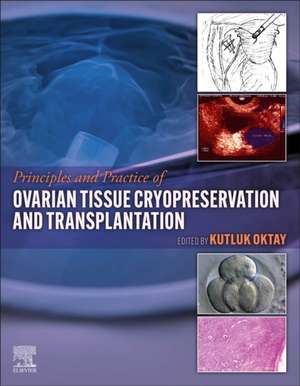 Principles and Practice of Ovarian Tissue Cryopreservation and Transplantation de Kutluk Oktay