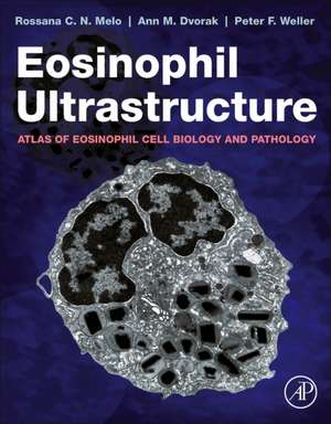 Eosinophil Ultrastructure: Atlas of Eosinophil Cell Biology and Pathology de Rossana C.N. Melo