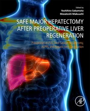 Safe Major Hepatectomy after Preoperative Liver Regeneration: Preopearative PVE, Two-Satage Hepatetomy, ALPPS and Hepatic Vein Deprivation de Yoshihiro Sakamoto