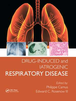 Drug-induced and Iatrogenic Respiratory Disease de Phillipe Camus