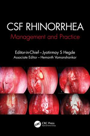 CSF Rhinorrhoea: Management and Practice de Jyotirmay S. Hegde