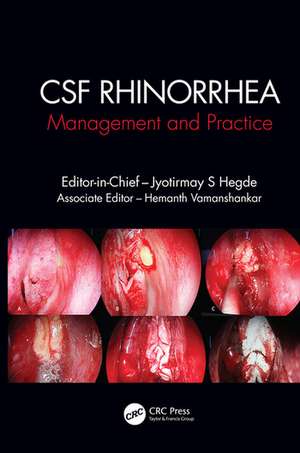 CSF Rhinorrhoea: Management and Practice de Jyotirmay S. Hegde