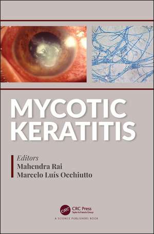 Mycotic Keratitis de Mahendra Rai