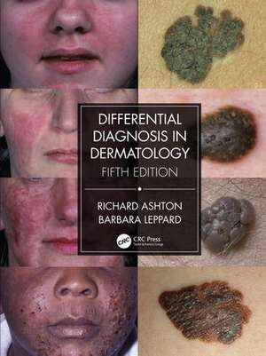 Differential Diagnosis in Dermatology de Richard Ashton