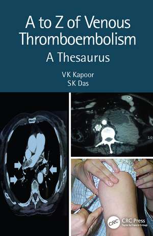 A to Z of Venous Thromboembolism: A Thesaurus de VK Kapoor