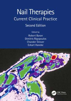 Nail Therapies: Current Clinical Practice de Robert Baran