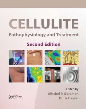 Cellulite: Pathophysiology and Treatment de Mitchel P. Goldman