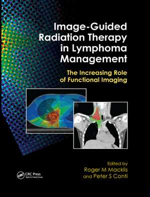 Image-Guided Radiation Therapy in Lymphoma Management: The Increasing Role of Functional Imaging de Roger M. Macklis