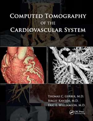 Computed Tomography of the Cardiovascular System de Thomas C. Gerber