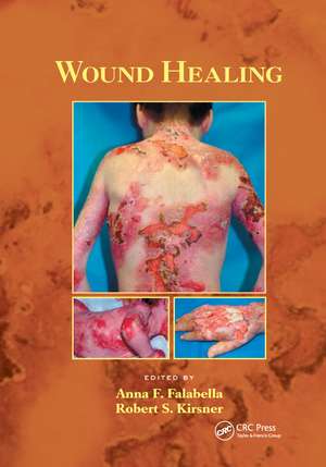 Wound Healing de Anna Falabella