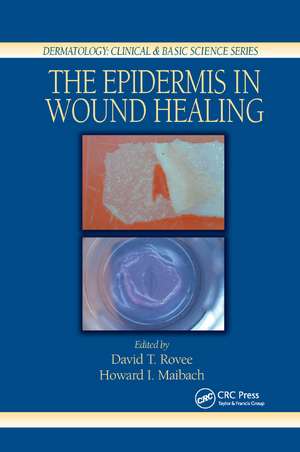 The Epidermis in Wound Healing de David T. Rovee