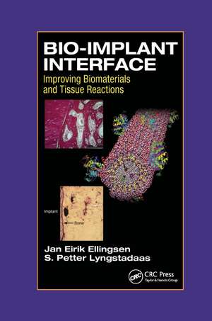 Bio-Implant Interface: Improving Biomaterials and Tissue Reactions de J.E. Ellingsen