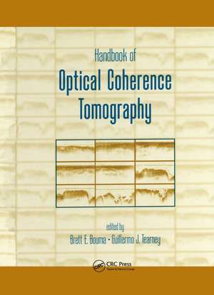 Handbook of Optical Coherence Tomography de Brett Bouma