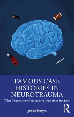 Famous Case Histories in Neurotrauma: What neuroscience continues to learn from survivors de Jessica Matyas