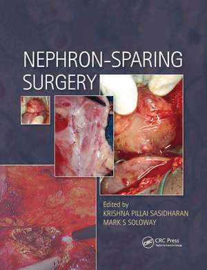 Nephron-Sparing Surgery de Krishna Sasidharan