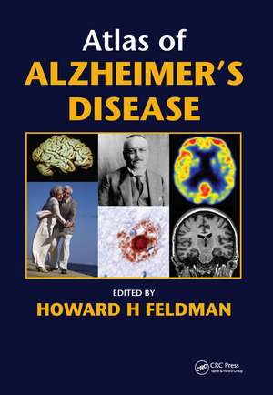 Atlas of Alzheimer's Disease de Howard Feldman