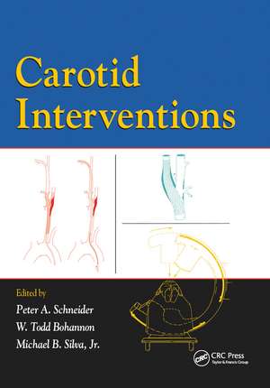 Carotid Interventions de Peter Schneider