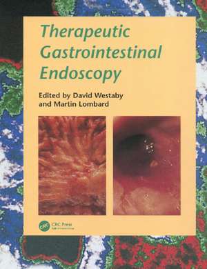 Therapeutic Gastrointestinal Endoscopy de David Westaby