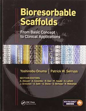 Bioresorbable Scaffolds: From Basic Concept to Clinical Applications de Yoshinobu Onuma