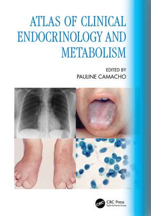 Atlas of Clinical Endocrinology and Metabolism de Pauline Camacho