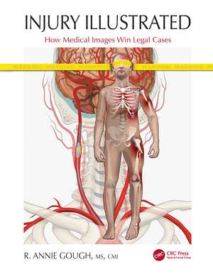 Injury Illustrated: How Medical Images Win Legal Cases de R. Annie Gough