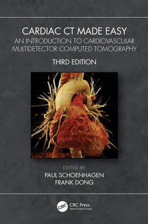 Cardiac CT Made Easy: An Introduction to Cardiovascular Multidetector Computed Tomography de Paul Schoenhagen