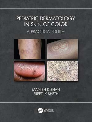 Pediatric Dermatology in Skin of Color: A Practical Guide de Manish K Shah