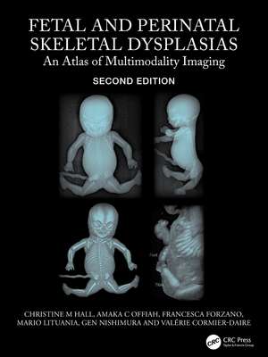 Fetal and Perinatal Skeletal Dysplasias: An Atlas of Multimodality Imaging de Christine M Hall