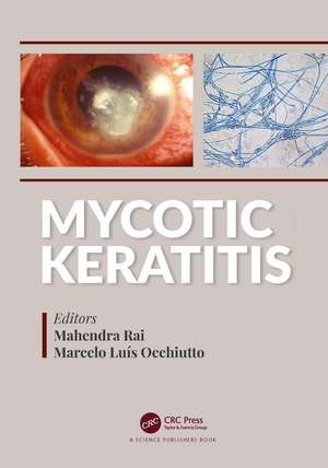 Mycotic Keratitis de Mahendra Rai